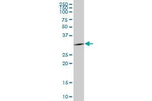 anti-FLJ25006 (AA 1-274) antibody