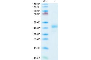 CD52 Protein (CD52) (AA 25-36) (Fc Tag)