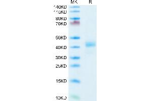 Human CD52 on Tris-Bis PAGE under reduced condition. (CD52 Protein (CD52) (AA 25-36) (Fc Tag))