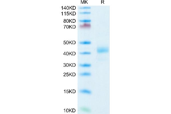 CD52 Protein (CD52) (AA 25-36) (Fc Tag)