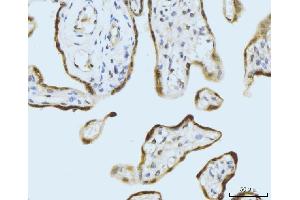 IHC analysis of SBNO1 using anti-SBNO1 antibody (ABIN7601710). (SBNO1 Antikörper  (AA 43-1303))