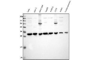 Western blot analysis of VAPB using anti-VAPB antibody (ABIN5693292). (VAPB Antikörper  (AA 2-55))
