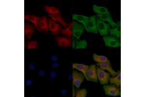 ABIN6259406 and ABIN6276177 staining Hela cells by IF/ICC.