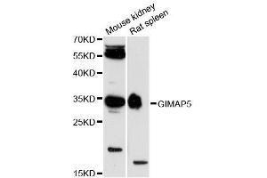 Western blot analysis of extracts of various cell lines, using GIMAP5 antibody (ABIN5996705) at 1:3000 dilution. (GIMAP5 Antikörper)