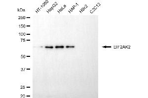 Western blotting analysis using EIF2AK2 antibody (ABIN7798506).