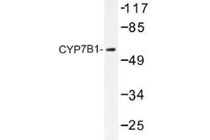 Image no. 1 for anti-Cytochrome P450, Family 7, Subfamily B, Polypeptide 1 (CYP7B1) antibody (ABIN317809) (CYP7B1 Antikörper)