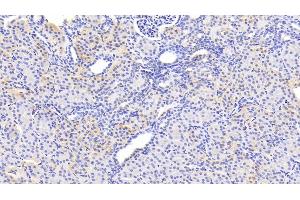 Detection of SERPINB3 in Human Kidney Tissue using Polyclonal Antibody to Serpin B3 (SERPINB3) (SERPINB3 Antikörper  (AA 1-210))
