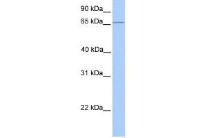 WB Suggested Anti-CLCNKA Antibody Titration:  0. (CLCNKA Antikörper  (N-Term))