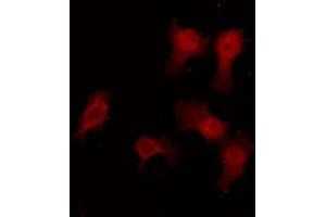 ABIN6272458 staining HuvEc by IF/ICC. (Vomeronasal 1 Receptor 3 (VMN1R3) Antikörper)