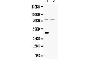 Western blot analysis of Factor I using anti- Factor I antibody .