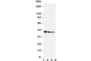 Western blot testing of ERBB4 antibody and Lane 1:  Recombinant human protein 10ng;  2: 5ng;  3: 2. (ERBB4 Antikörper  (N-Term))