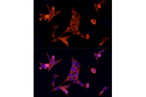 Immunofluorescence analysis of NIH/3T3 cells using MTAP Rabbit mAb (ABIN7268498) at dilution of 1:100 (40x lens). (MTAP Antikörper)
