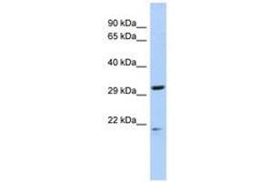 Image no. 1 for anti-Chromosome 14 Open Reading Frame 80 (C14ORF80) (AA 195-228) antibody (ABIN6741367) (C14ORF80 Antikörper  (AA 195-228))