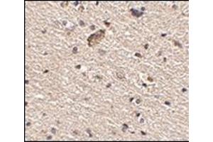 Immunohistochemistry of Spred1 in human brain tissue with this product at 2. (SPRED1 Antikörper  (Center))