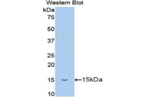 Western blot analysis of recombinant Mouse TFF2.
