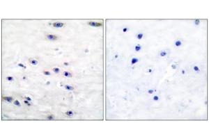Immunohistochemical analysis of paraffin-embedded human brain tissue using Tyrosine Hydroxylase (epitope around residue 19) antibody (ABIN5976157). (Tyrosine Hydroxylase Antikörper  (Ser19))