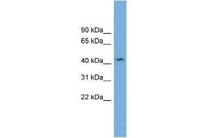 Western Blotting (WB) image for anti-UDP-Gal:betaGlcNAc beta 1,4- Galactosyltransferase, Polypeptide 3 (B4GALT3) (N-Term) antibody (ABIN2782250)