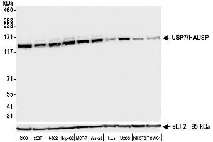 Western Blotting (WB) image for anti-Ubiquitin Specific Peptidase 7 (Herpes Virus-Associated) (USP7) (AA 1-50) antibody (ABIN7453991) (Rekombinanter USP7 Antikörper  (AA 1-50))