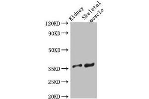 Western Blot Positive WB detected in: Mouse kidney tissue, Mouse skeletal muscle tissue All lanes: SLC25A32 antibody at 3 μg/mL Secondary Goat polyclonal to rabbit IgG at 1/50000 dilution Predicted band size: 36 kDa Observed band size: 36 kDa (SLC25A32 Antikörper  (AA 44-88))
