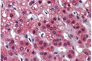 Human Adrenal: Formalin-Fixed, Paraffin-Embedded (FFPE) (Calcyphosine 2 Antikörper  (Internal Region))