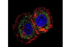 Fluorescent confocal image of MCF-7 cell stained with ER antibody at 1:25.