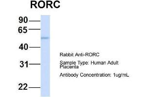 Host:  Rabbit  Target Name:  RORC  Sample Type:  Human Adult Placenta  Antibody Dilution:  1. (RORC Antikörper  (Middle Region))