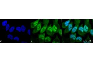 Immunocytochemistry/Immunofluorescence analysis using Rabbit Anti-Phosphothreonine Polyclonal Antibody . (Phosphothreonine Antikörper  (FITC))