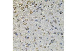 Immunohistochemistry of paraffin-embedded mouse brain using CREBBP antibody (ABIN5974440) at dilution of 1/100 (40x lens). (CBP Antikörper)