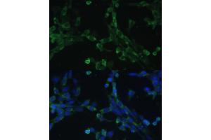 Immunofluorescence analysis of NIH-3T3 cells using eEF1G Polyclonal Antibody (ABIN6133514, ABIN6139951, ABIN6139952 and ABIN6223877) at dilution of 1:100 (40x lens). (EEF1G Antikörper  (AA 168-437))