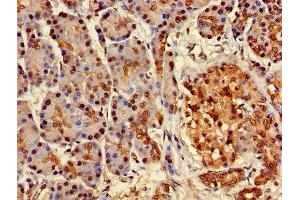 Immunohistochemistry of paraffin-embedded human pancreatic tissue using ABIN7144793 at dilution of 1:100 (Ataxin 3 Antikörper  (AA 1-288))