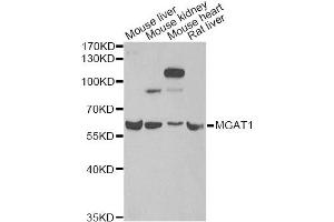 Western blot analysis of extracts of various cell lines, using MGAT1 antibody. (MGAT1 Antikörper)