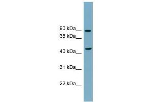 SMPD2 antibody used at 1 ug/ml to detect target protein. (SMPD2 Antikörper)