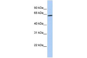 WB Suggested Anti-ZNF397 Antibody Titration:  0.