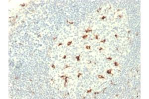 Immunohistochemistry (IHC) image for anti-CD68 Molecule (CD68) (AA 150-221) antibody (ABIN6941248)