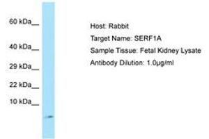 Image no. 1 for anti-Small EDRK-Rich Factor 1A (Telomeric) (SERF1A) (C-Term) antibody (ABIN6750135) (SERF1A Antikörper  (C-Term))
