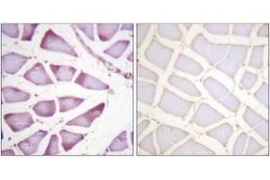 Immunohistochemistry analysis of paraffin-embedded human skeletal muscle tissue, using S6 Ribosomal Protein (Ab-240) Antibody. (RPS6 Antikörper  (AA 191-240))