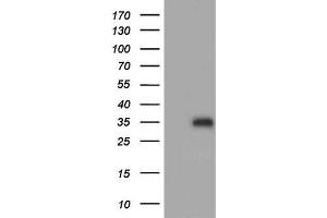 Western Blotting (WB) image for anti-Adiponectin (ADIPOQ) (AA 19-244) antibody (ABIN2715777) (ADIPOQ Antikörper  (AA 19-244))