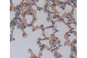 Used in DAB staining on fromalin fixed paraffin- embedded lung tissue (NCR1 Antikörper  (AA 17-258))