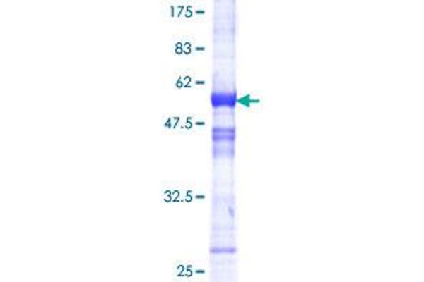 RCAN1 Protein (AA 1-197) (GST tag)