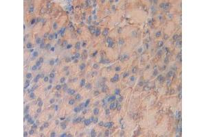 #VALUE! (INSRR Antikörper  (AA 1067-1296))