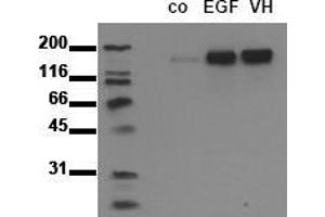Western Blotting (WB) image for anti-Epidermal Growth Factor Receptor (EGFR) (pTyr1092) antibody (ABIN126770) (EGFR Antikörper  (pTyr1092))