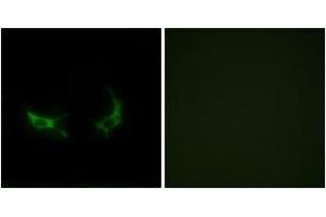 Immunofluorescence analysis of LOVO cells, using OR2M3 Antibody. (OR2M3 Antikörper  (AA 241-290))