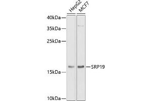 Western blot analysis of extracts of various cell lines, using SRP19 antibody (ABIN6129677, ABIN6148450, ABIN6148451 and ABIN6222484) at 1:1000 dilution. (SRP19 Antikörper  (AA 1-144))