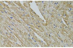 Immunohistochemistry of paraffin-embedded Mouse heart using FHIT Polyclonal Antibody at dilution of 1:100 (40x lens). (FHIT Antikörper)