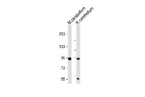 Anti-TRPV1 Antibody (N-term) at 1:1000 dilution Lane 1:Mouse cerebellum lysate Lane 2:Rat cerebellum lysate Lysates/proteins at 20 μg per lane.