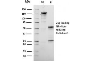 SDS-PAGE Analysis Purified Dystrophin Monospecific Mouse Monoclonal Antibody (DMD/3245).
