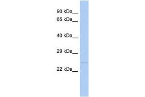 Western Blotting (WB) image for anti-Tumor Necrosis Factor Receptor Superfamily, Member 10c (TNFRSF10C) (N-Term) antibody (ABIN2774599)
