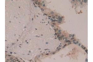 Immunohistochemistry (IHC) image for anti-Hepatoma-Derived Growth Factor (HDGF) (AA 10-240) antibody (ABIN7432232)