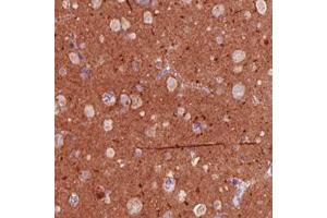 Immunohistochemical staining (Formalin-fixed paraffin-embedded sections) of human cerebral cortex with TSPAN7 monoclonal antibody, clone CL0262  shows strong immunoreactivity in the neuropil.