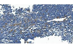 anti-Interleukin 2 Receptor, beta (IL2RB) (AA 268-551) antibody